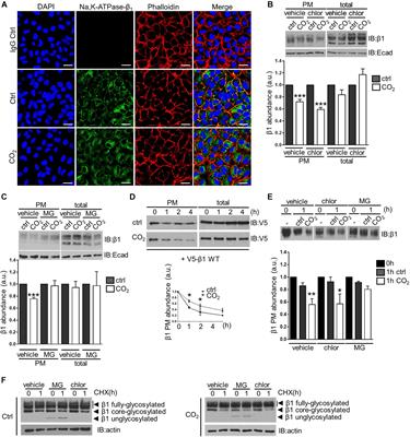 TRAF2 Is a Novel Ubiquitin E3 Ligase for the Na,K-ATPase β-Subunit That Drives Alveolar Epithelial Dysfunction in Hypercapnia